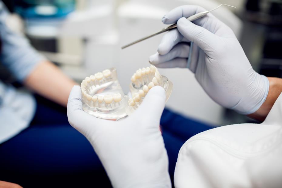 Dental implants