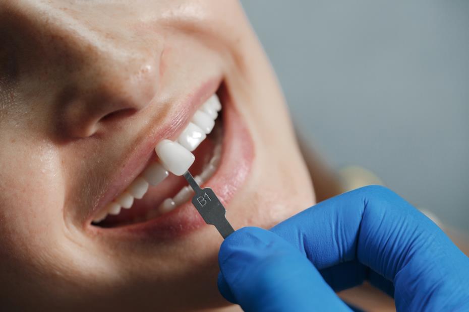 Cosmetic dentistry