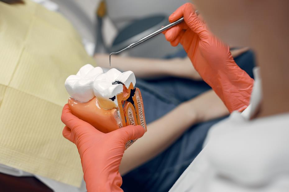 Root canal treatment 