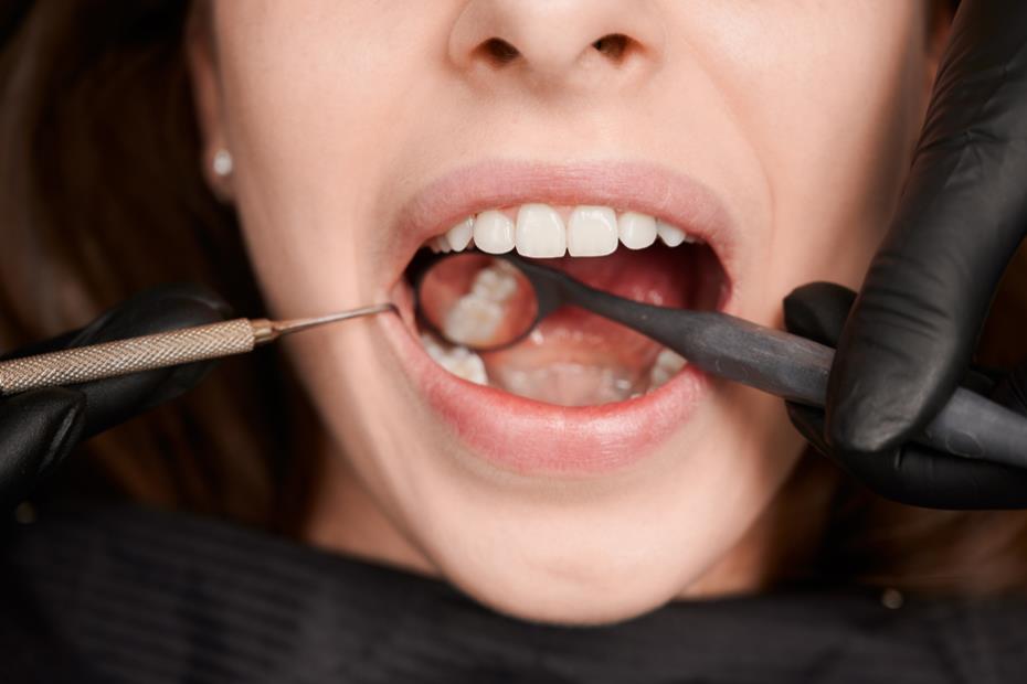 Periodontal treatment 