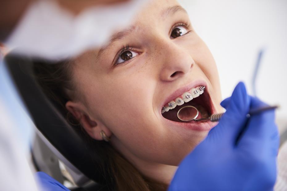 Orthodontic treatment 